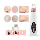 Removedor de Cravos a Vácuo - Pelavia®